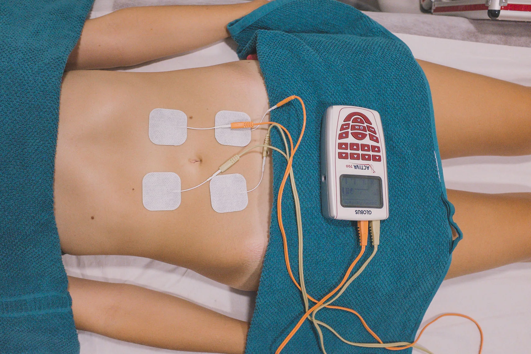 Tratamiento de electroterapia
